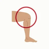 squishykneecaps